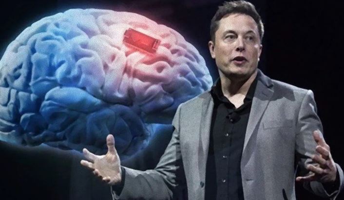 Neuralink úspešne implantoval mozgový čip človeku
