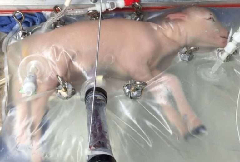 Umelá maternica sa pripravuje na použitie predčasne narodeným dieťaťom po pokusoch s jahňaciami